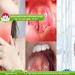 Ảnh đại diện bài viết