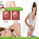 Ảnh đại diện bài viết