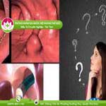 Ảnh đại diện bài viết