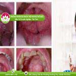 Ảnh đại diện bài viết