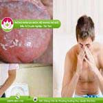 Ảnh đại diện bài viết