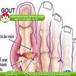 Ảnh đại diện bài viết