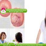 Ảnh đại diện bài viết