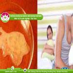 Ảnh đại diện bài viết