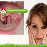 Ảnh đại diện bài viết