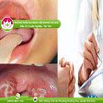 Ảnh đại diện bài viết