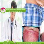 Ảnh đại diện bài viết