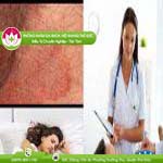 Ảnh đại diện bài viết