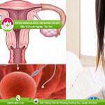 Ảnh đại diện bài viết