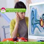 Ảnh đại diện bài viết