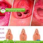 Ảnh đại diện bài viết