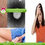 Ảnh đại diện bài viết