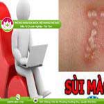 Ảnh đại diện bài viết