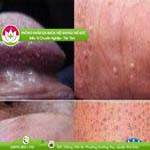 Ảnh đại diện bài viết