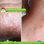 Ảnh đại diện bài viết