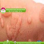 Ảnh đại diện bài viết