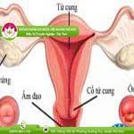 Ảnh đại diện bài viết