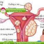 Ảnh đại diện bài viết