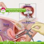 Ảnh đại diện bài viết