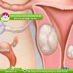 Ảnh đại diện bài viết