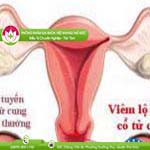 Ảnh đại diện bài viết
