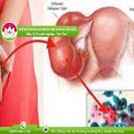 Ảnh đại diện bài viết