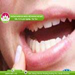 Ảnh đại diện bài viết