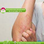 Ảnh đại diện bài viết