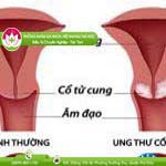 Ảnh đại diện bài viết