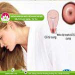 Ảnh đại diện bài viết