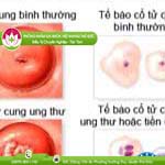 Ảnh đại diện bài viết