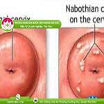 Ảnh đại diện bài viết