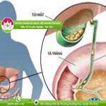 Ảnh đại diện bài viết