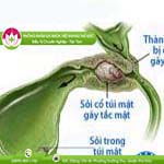 Ảnh đại diện bài viết
