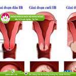 Ảnh đại diện bài viết