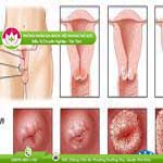 Ảnh đại diện bài viết
