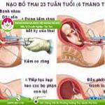 Ảnh đại diện bài viết