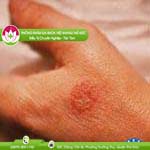 Ảnh đại diện bài viết