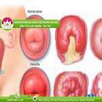 Ảnh đại diện bài viết