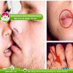 Ảnh đại diện bài viết