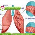 Ảnh đại diện bài viết