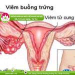 Ảnh đại diện bài viết