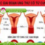 Ảnh đại diện bài viết