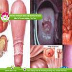 Ảnh đại diện bài viết