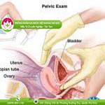 Ảnh đại diện bài viết