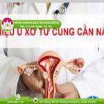 Ảnh đại diện bài viết