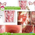 Ảnh đại diện bài viết