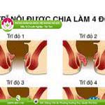 Ảnh đại diện bài viết