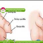 Ảnh đại diện bài viết