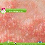 Ảnh đại diện bài viết